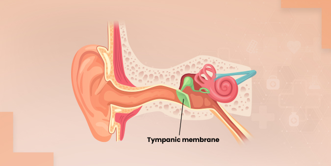 Tympanoplasty: Real Stories and Easy Recovery Tips
